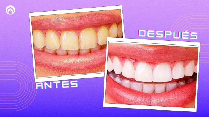 Cómo limpiar los dientes amarillos con un ingrediente natural sin gastar más de 20 pesos