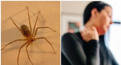 Araña Violinista: ¿qué es la necrosis y como se trata?