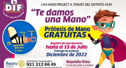 Conoce cómo solicitar una prótesis de mano gratuita en el DIF Coatzacoalcos