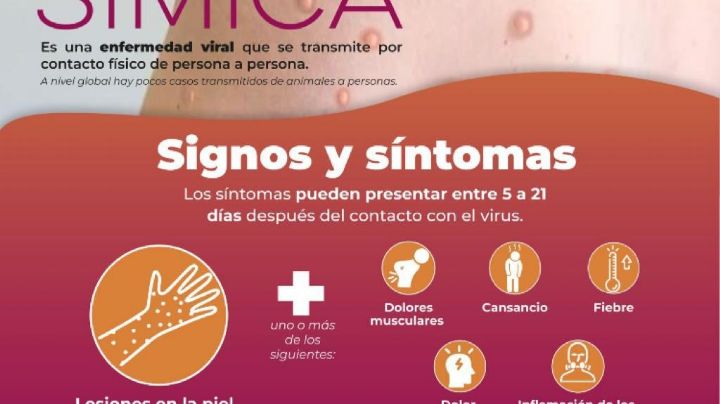 Confirma Secretaría de Salud dos casos de viruela símica en Sonora