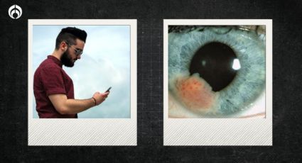 Cáncer ocular: ¿Te puede dar por estar todo el tiempo en el celular?