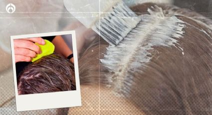 Tinte de cabello: ¿sirve para quitar los piojos?