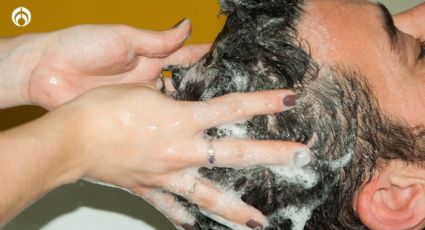 El shampoo anticaída que usa la clase alta y Liverpool lo tiene con descuentazo