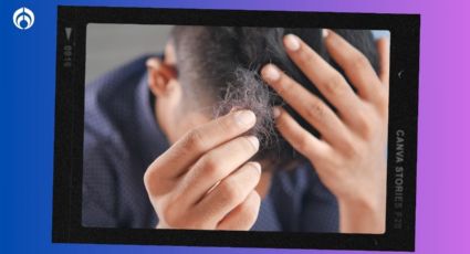 El shampoo para la caída de cabello que cuesta menos de 50 pesos, y es viral en TikTok