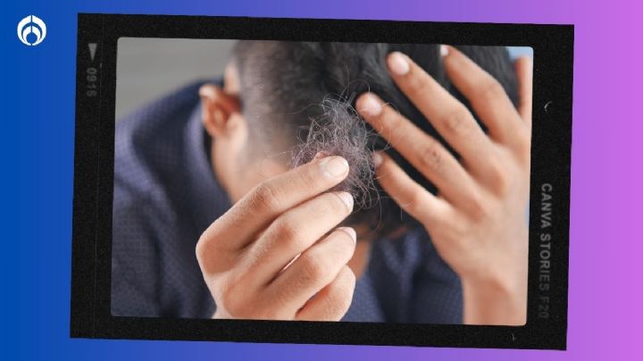 El shampoo para la caída de cabello que cuesta menos de 50 pesos, y es viral en TikTok