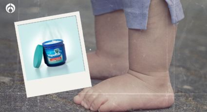 VapoRub: ¿Por qué es riesgoso usarlo en niños?