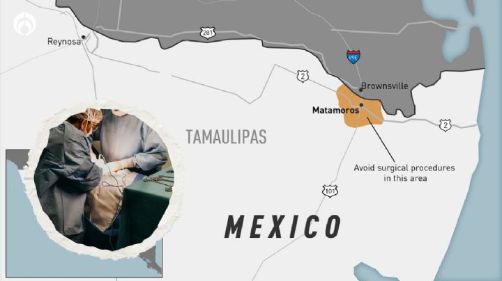 Nueva alerta por meningitis: ¿ahora qué está pasando en Tamaulipas?