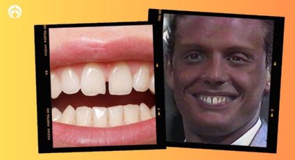 Luis Miguel: ¿qué significa tener los dientes separados como El Sol de México?