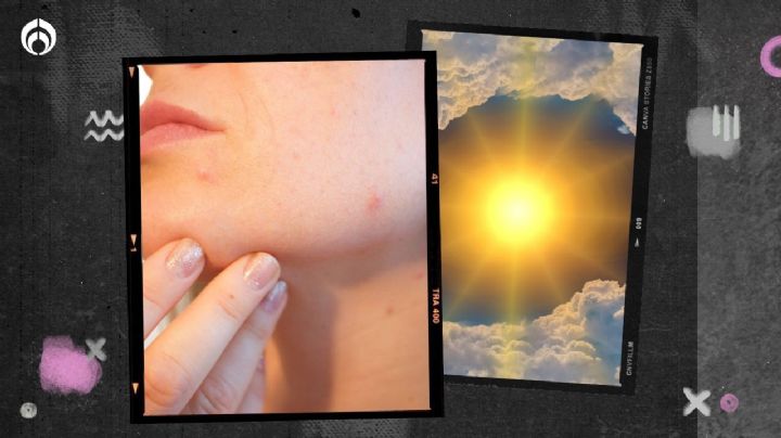 ¿Sufres por acné? Así debes proteger tu piel ante la ola de calor