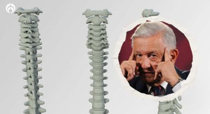 Así fue como AMLO evitó una operación en su columna; le quemaron los nervios, confiesa