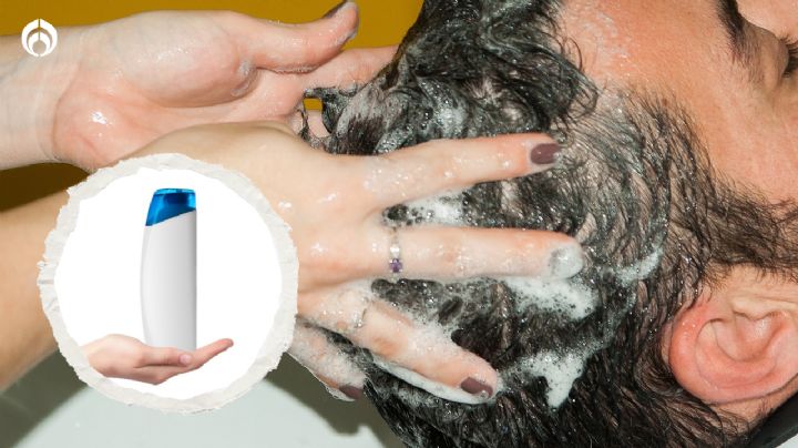 Los 5 mejores shampoos para cabello seco, recomendados por expertos