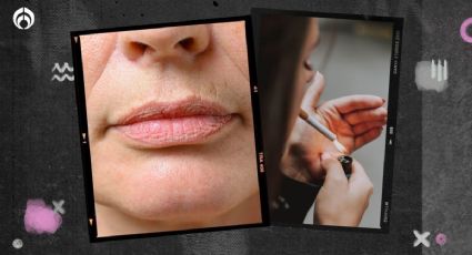 6 cosas que provocan 'arruguitas' en los labios y no sabías