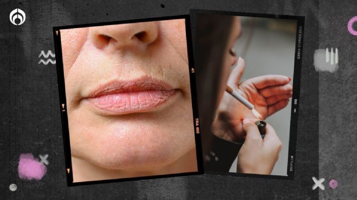 6 cosas que provocan 'arruguitas' en los labios y no sabías