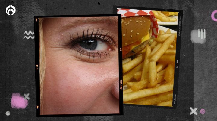 3 alimentos que ¡te causan arrugas! y lo no sabías