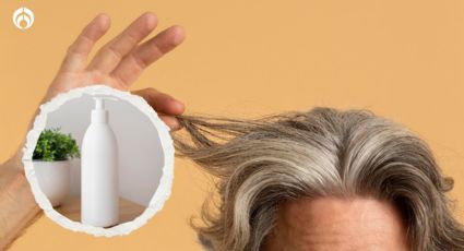 Por estas 3 razones tus canas se ponen amarillas; así puedes cubrirlas sin tinte