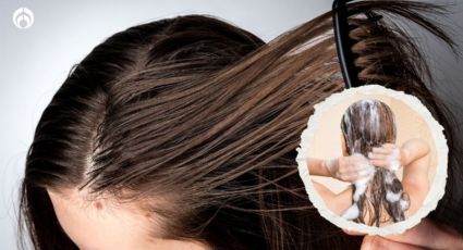 Los 5 mejores shampoos para cabello graso, según expertos