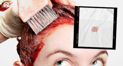 5 tips infalibles para quitar manchas de tinte de pelo en la ropa