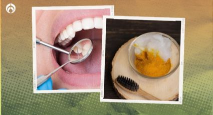 El remedio casero para remover las caries con ingredientes que tienes en tu alacena