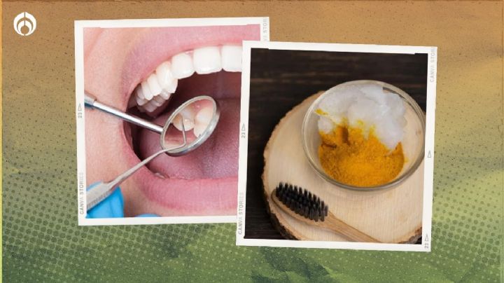 El remedio casero para remover las caries con ingredientes que tienes en tu alacena