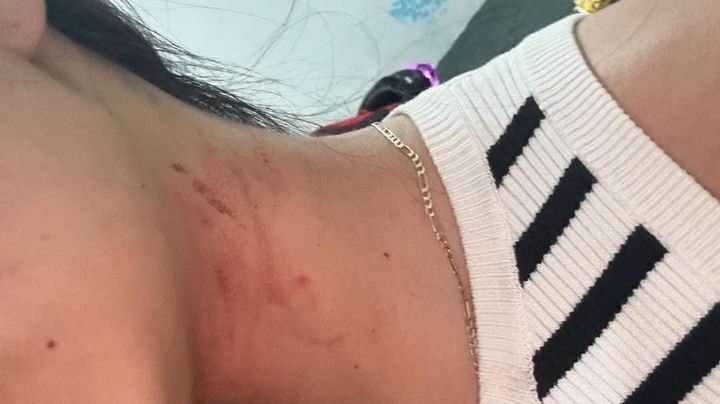 Joven denuncia por Instagram a su novio tras intentar quitarle la vida asifixiándola