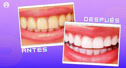 Cómo limpiar los dientes amarillos con un ingrediente natural sin gastar más de 20 pesos