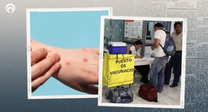 Sarampión: Salud emite alerta de viaje por riesgo de contagio