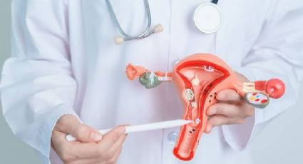 Cáncer cervicouterino: una de las principales causas de muerte en la mujeres