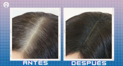 Bodega Aurerra rebaja el shampoo perfecto para reducir canas y evitar la caída del cabello