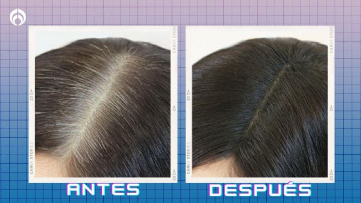 Bodega Aurerra rebaja el shampoo perfecto para reducir canas y evitar la caída del cabello