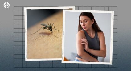 Picadura de mosquitos: 4 trucazos caseros para acabar con la molesta comezón