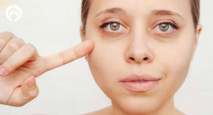 Trucazo efectivo para eliminar por completo las ojeras muy marcadas con un solo producto