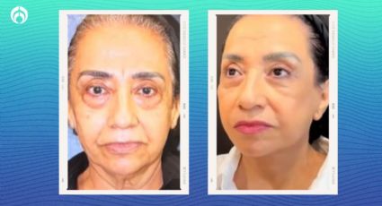 Mezcla poderosa y antiedad para lucir cara y manos de 30 a los 60; acaba con manchas y arrugas