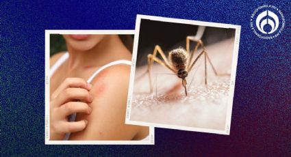 El truco fácil para quitar rápido la molesta roncha de la picadura de un mosquito