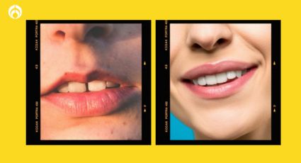 La manera correcta de cuidar tus labios para  que queden lindos y suaves