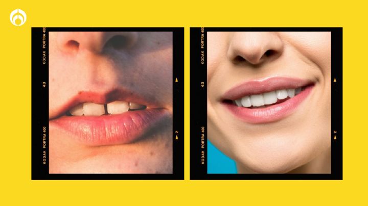 La manera correcta de cuidar tus labios para  que queden lindos y suaves