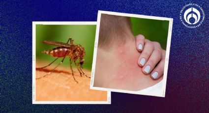 4 productos naturales para evitar picaduras de chinches, garrapatas, mosquitos y más