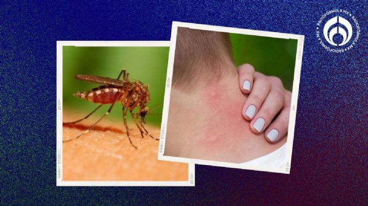 4 productos naturales para evitar picaduras de chinches, garrapatas, mosquitos y más