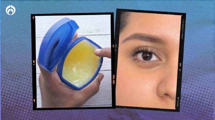 El truco de los dermatólogos con Vaselina para quitar las ojeras de forma inmediata