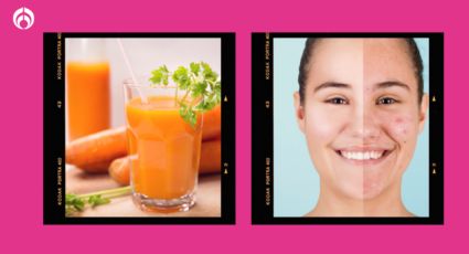 ¡Adiós al acné! El jugo natural de 5 ingredientes que te dejará la cara libre de imperfecciones