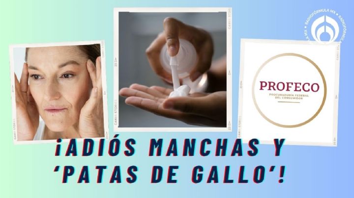 La crema con aval de Profeco que 'combate' patas de gallo, arrugas y manchas