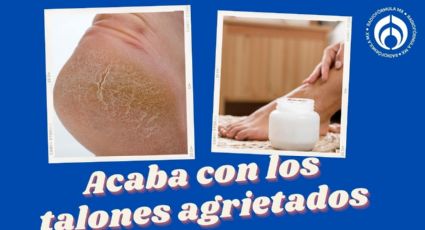 Adiós a los talones agrietados con esta crema barata y avalada por Profeco