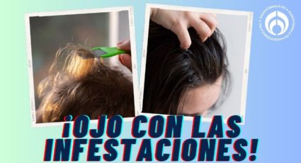 Temporada de piojos: cómo prevenir su transmisión antes de las olas de calor