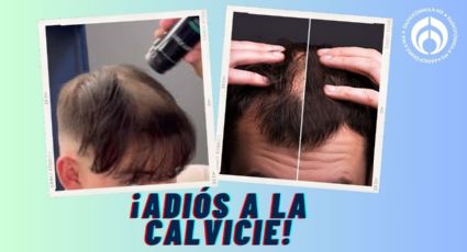 ¿Se te cae el cabello? Estas fibras capilares cubren la calvicie al instante y dan acabado natural